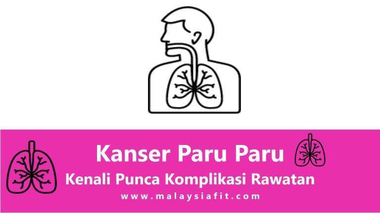 Kanser Paru Paru Kenali Punca Komplikasi Rawatan