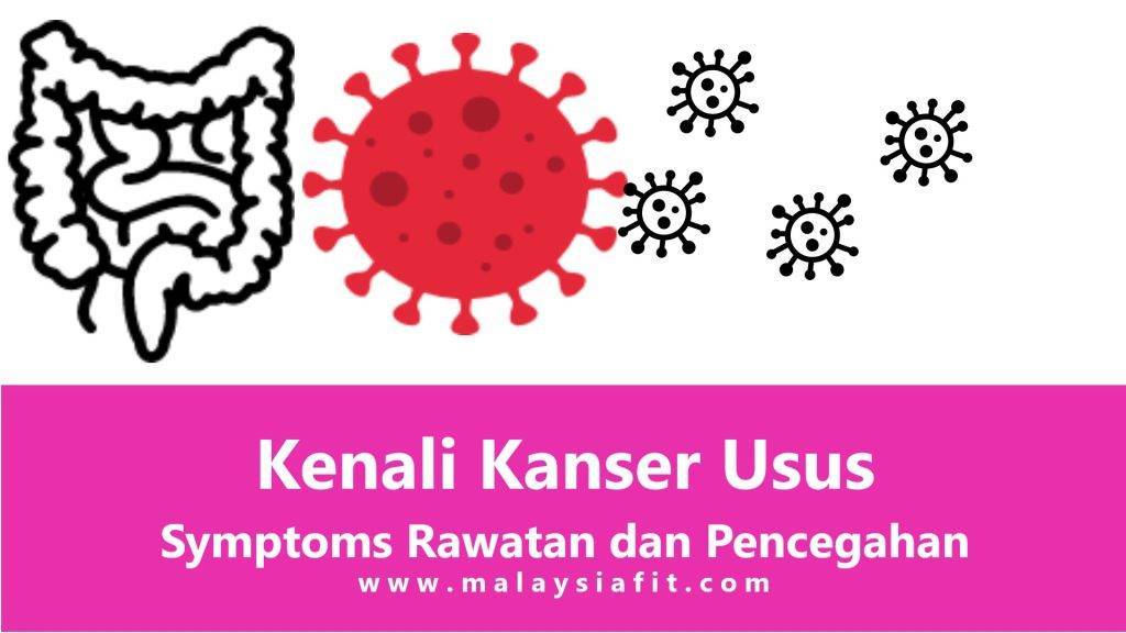 Kenali Kanser Usus Symptoms Rawatan Pencegahan