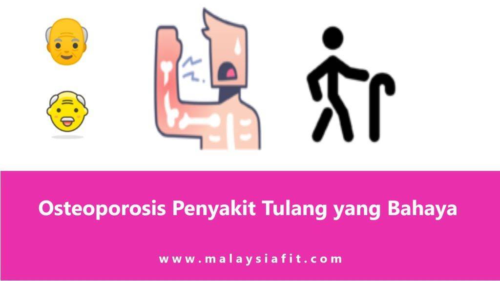 Osteoporosis Penyakit Tulang yang Bahaya