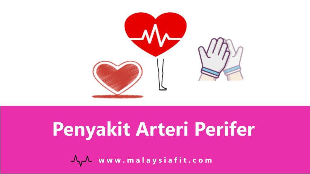Penyakit Arteri Perifer